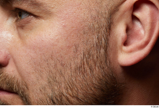 HD Face Skin Neeo bearded ear face skin pores skin…